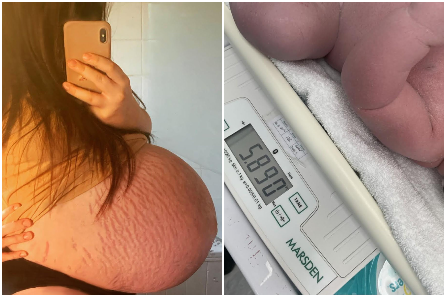 Medicii s-au îngrozit în timpul unei operații de cezariană: ce au găsit în burta acestei femei