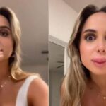 A mers să-și mărească buzele, însă experiența s-a transformat într-un coșmar: "Zici că sunt Grinch"