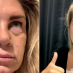 O femeie a fost la un pas de moarte din cauza implanturilor mamare: „Nu puteam nici să mă ridic”