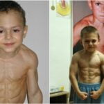Cum a ajuns să arate “Micul Hercule”, copilul care a şocat România când avea 2 ani. Giuliano Stroe a devenit major şi e de nerecunoscut