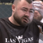 FOTO Verdictul medicilor pentru românul care s-a lăsat desfigurat pentru 5.000 de euro