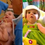 S-au născut cu trupurile lipite și medicii au făcut eforturi pentru a le separa. Cum arată siamezele la vârsta adolescenței