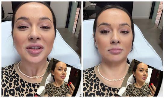 Vlăduța Lupău, pe mâna medicilor esteticieni: "Este efectul ăla de care zice toată lumea… bot de rață"