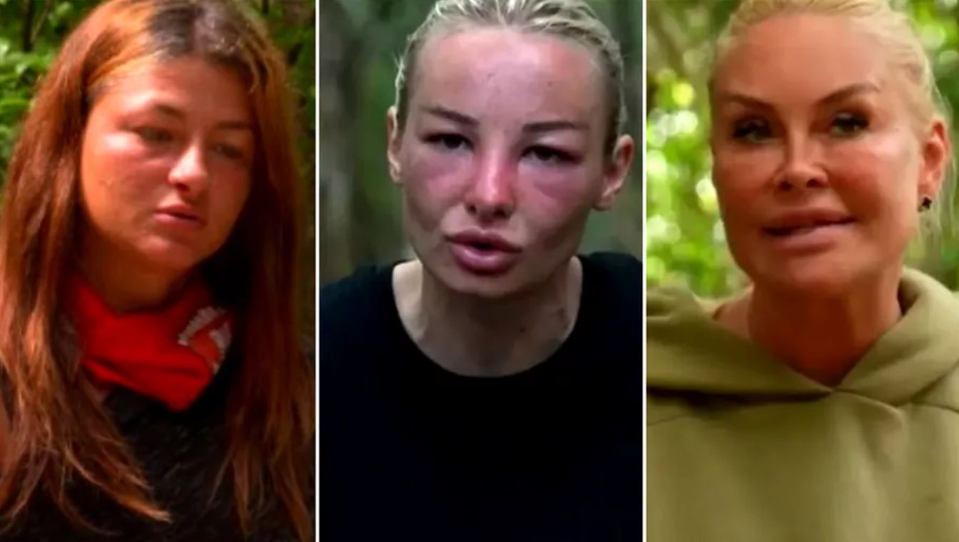 De ce li se umflă fața concurentelor de la Survivor?