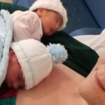 Caz rar de naștere gemelară. Cei doi copii au venit pe lume în aceeași secundă