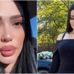Tânără de 22 de ani, moartă după ce a vrut să-și mărească fesele într-un cabinet neautorizat, în Rusia. Prietena ei era "medicul": "Înainte punea gene false"