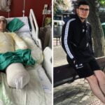 Drama unui tânăr român din Spania: A rămas fără mâini și picioare din cauza unei boli grave