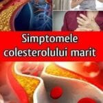 Cele 10 simptome ale nivelului crescut de colesterol