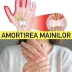 AMORȚIREA MÂINILOR. Tu știi de ce îți amorțesc mâinile în timpul somnului.. E un semnal de alarma