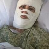 Femeie de 46 de ani, atacată cu acid într-un parc. Agresorul este căutat de poliție și FBI